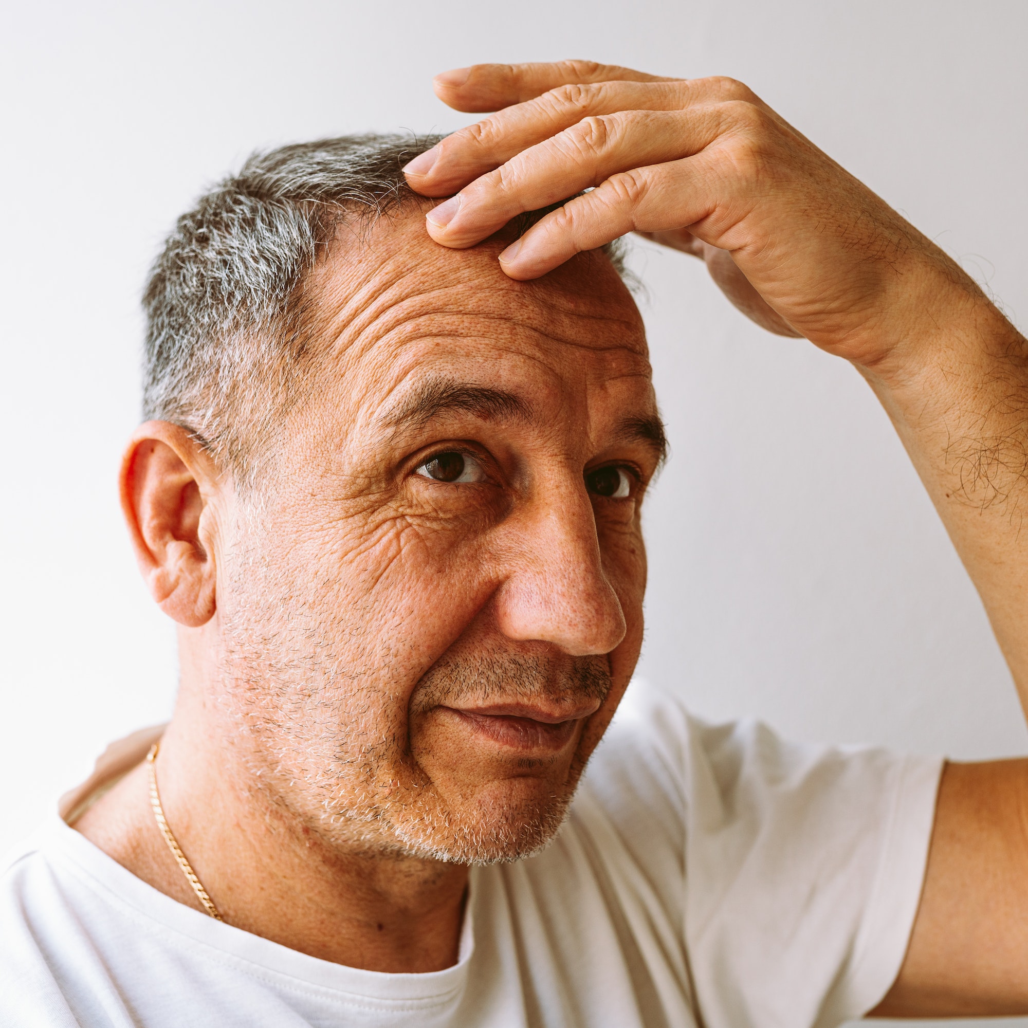 Middle-aged man demonstrates gray hair, hair loss problem, close-up